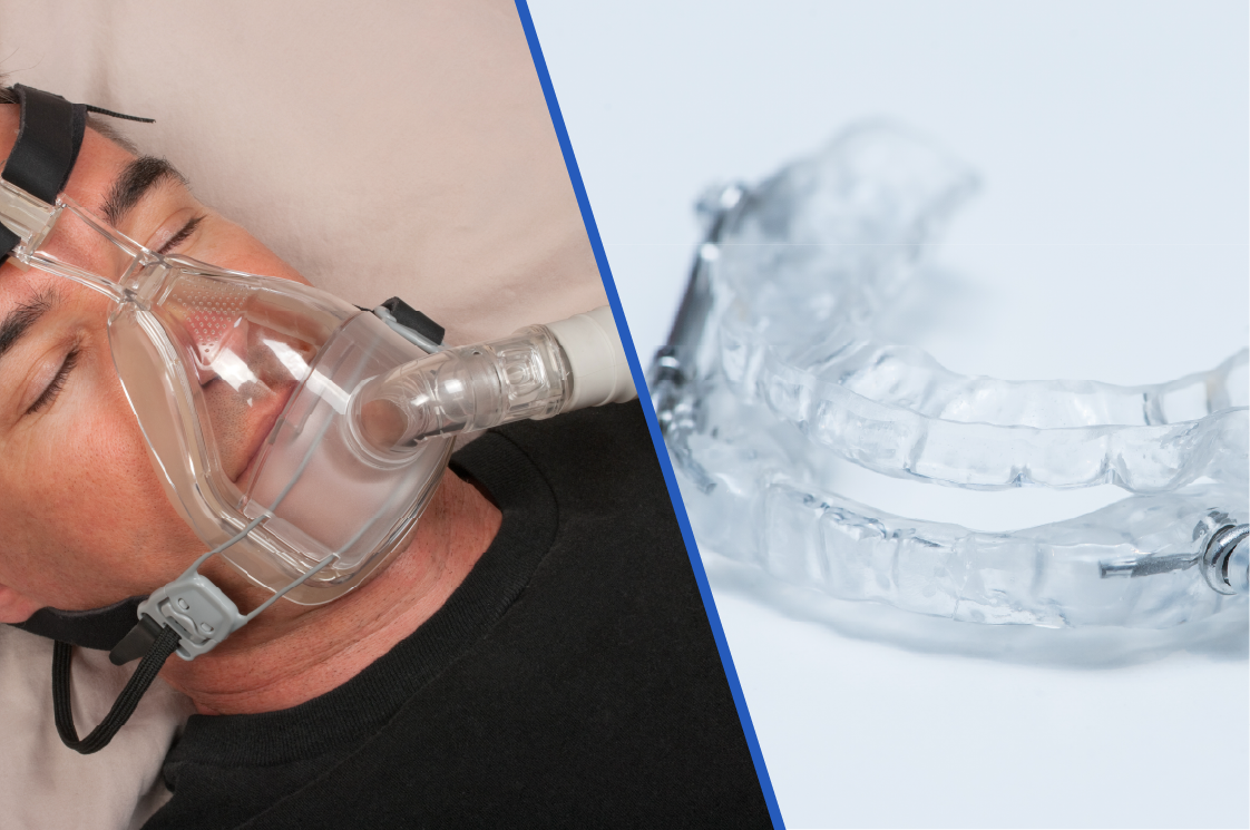 Schnarchtherapie im Vergleich: CPAP-Maske & Schnarcher Schiene